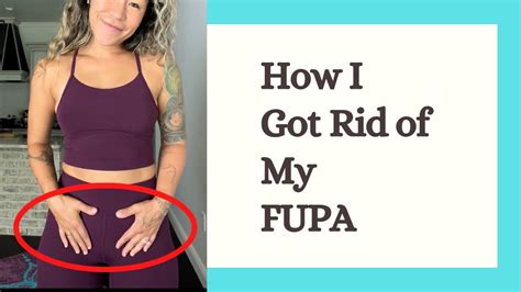 mature fupa|Treating Excess Fat In The Pubic Area (FUPA)